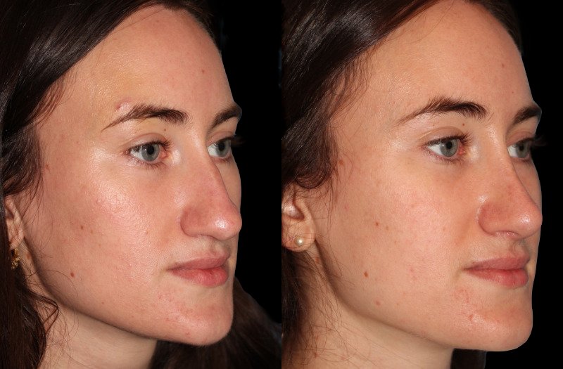 Patient 38 Combined Image