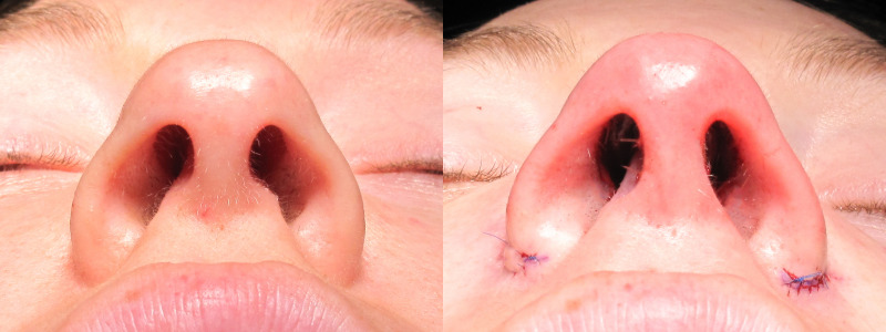 Patient 17 Combined Image