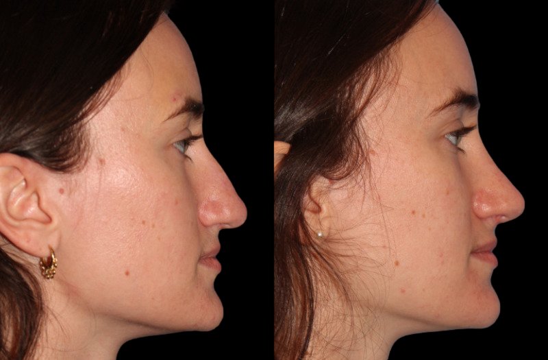 Patient 38 Combined Image