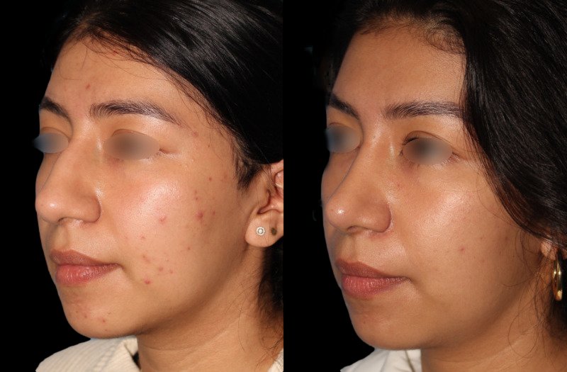 Patient 44 Combined Image