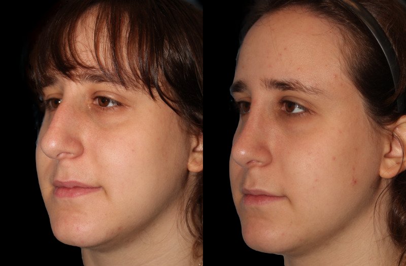 Patient 45 Combined Image