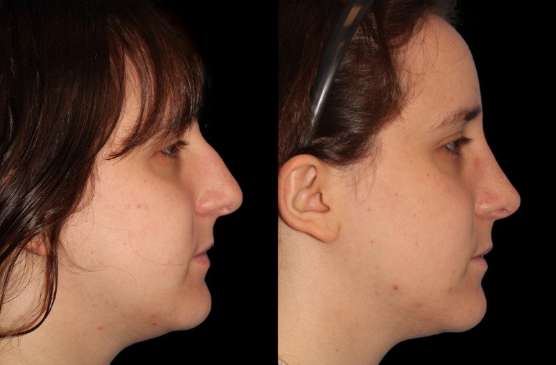 Patient 45 Combined Image