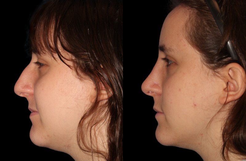 Patient 45 Combined Image