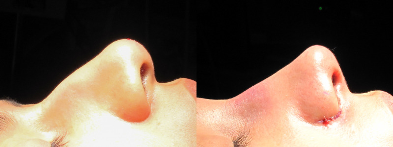 Patient 20 Combined Image