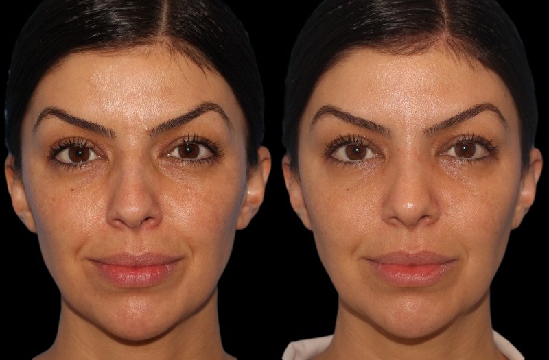 Patient 47 Combined Image