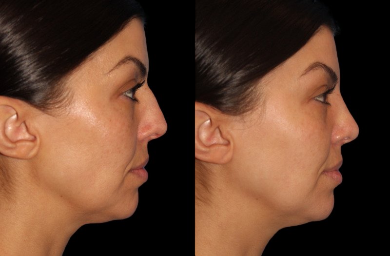 Patient 47 Combined Image