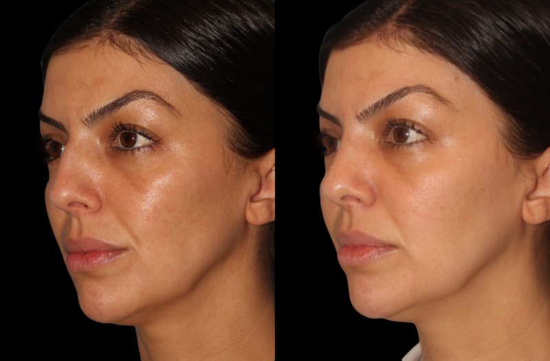 Patient 47 Combined Image