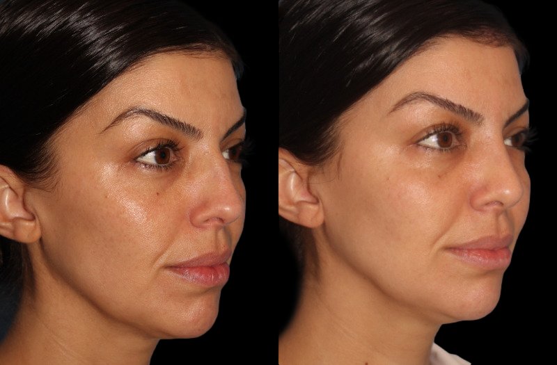 Patient 47 Combined Image