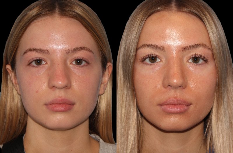 Patient 48 Combined Image