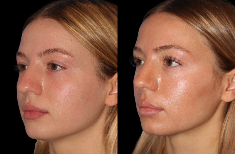 Patient 48 Combined Image