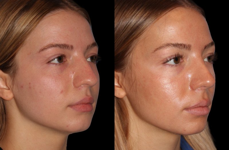 Patient 48 Combined Image