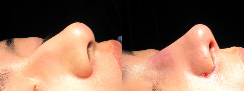 Patient 20 Combined Image