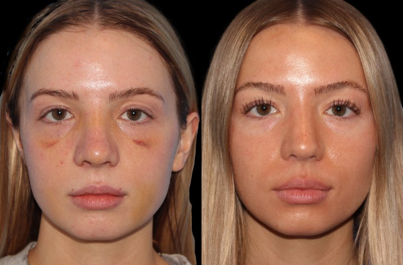 Patient 48 Combined Image