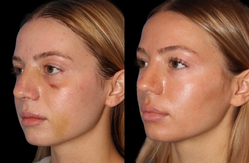 Patient 48 Combined Image
