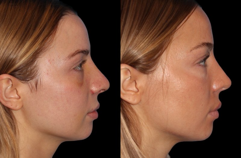 Patient 48 Combined Image