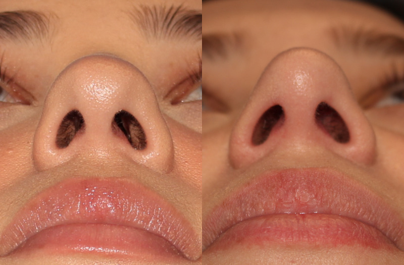 Patient 49 Combined Image