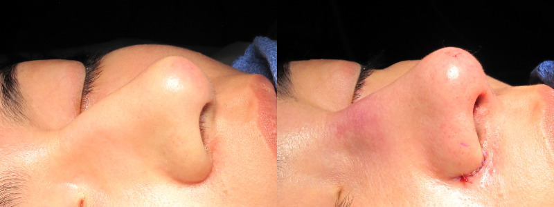 Patient 20 Combined Image