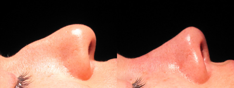 Patient 23 Combined Image