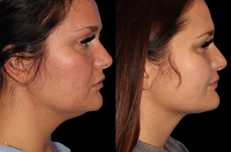 Patient 40 Combined Image