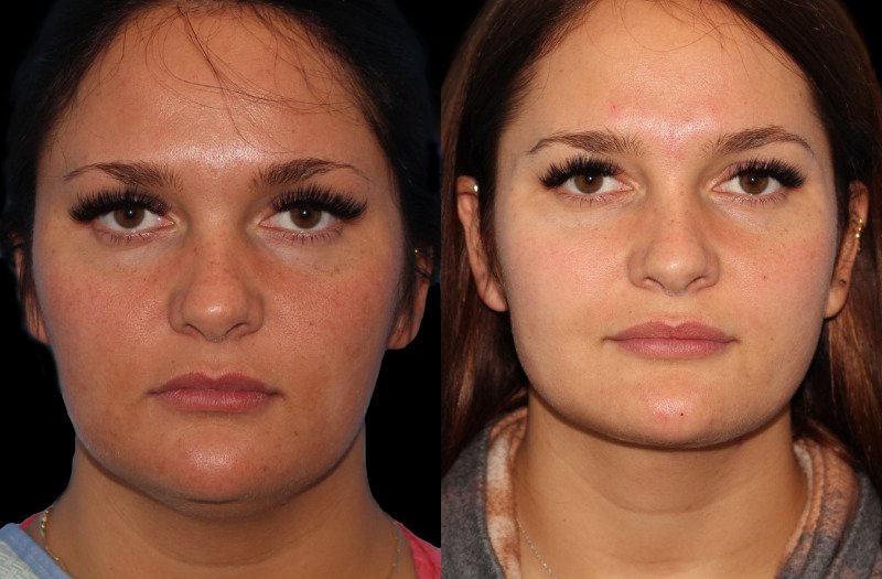 Patient 40 Combined Image