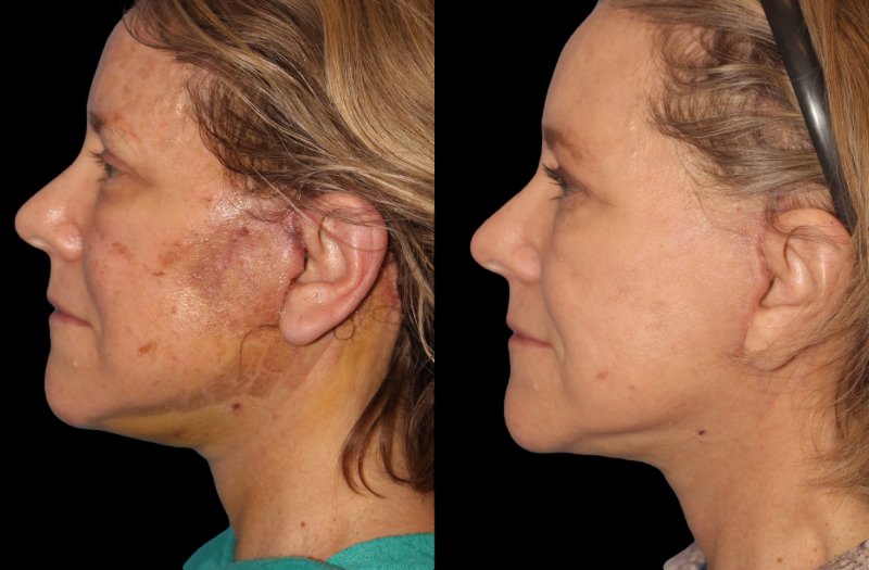 Patient 16 Combined Image