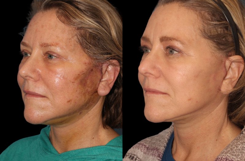 Patient 16 Combined Image