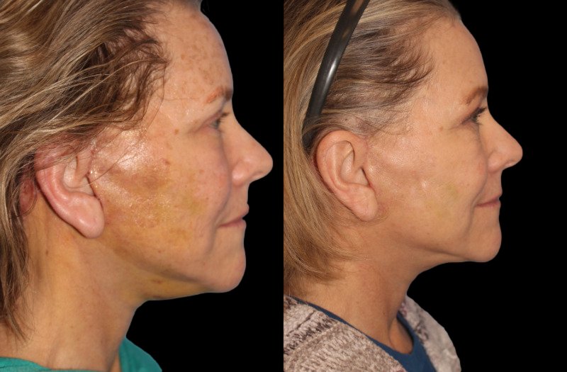 Patient 16 Combined Image