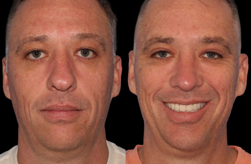 Patient 43 Combined Image