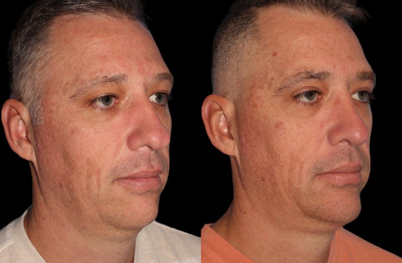 Patient 43 Combined Image