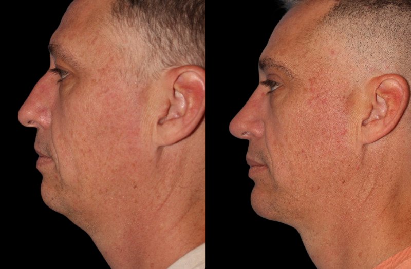 Patient 43 Combined Image