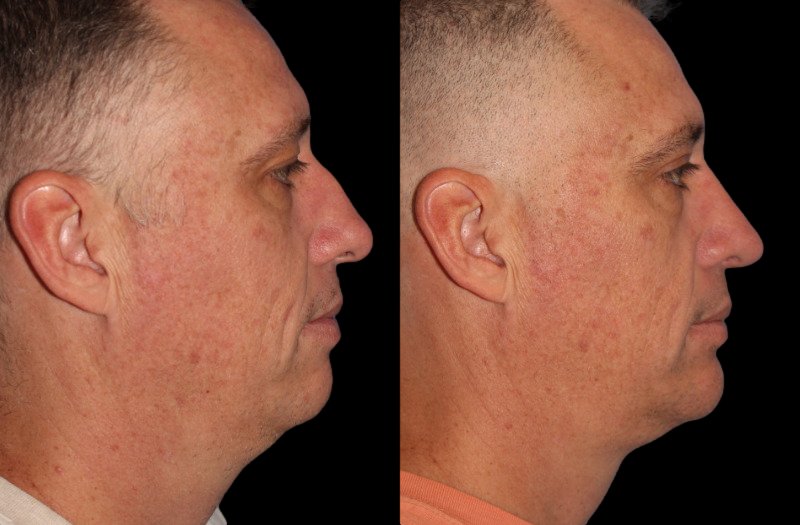 Patient 43 Combined Image