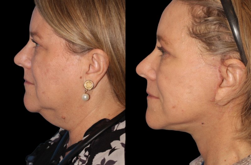 Patient 16 Combined Image