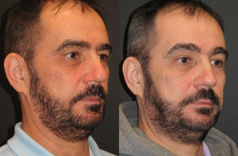 Patient #43054 Combined Image