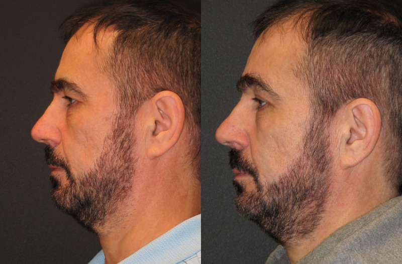 Patient #43054 Combined Image