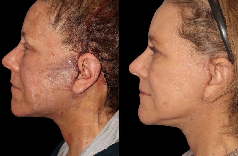 Patient 16 Combined Image