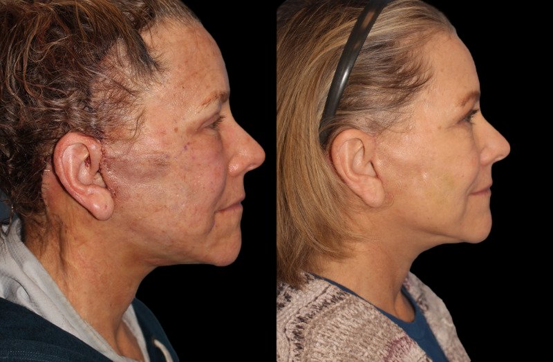 Patient 16 Combined Image