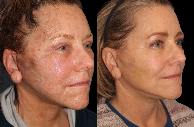 Patient 16 Combined Image