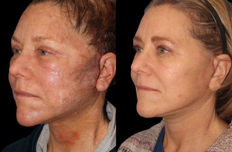 Patient 16 Combined Image