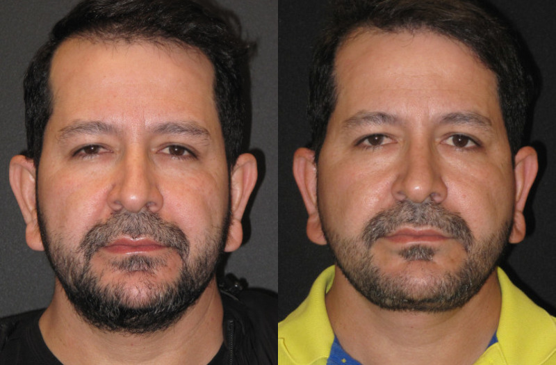 Patient 69 Combined Image