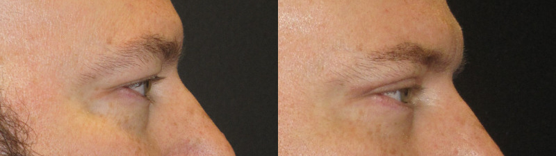 Patient 64 Combined Image