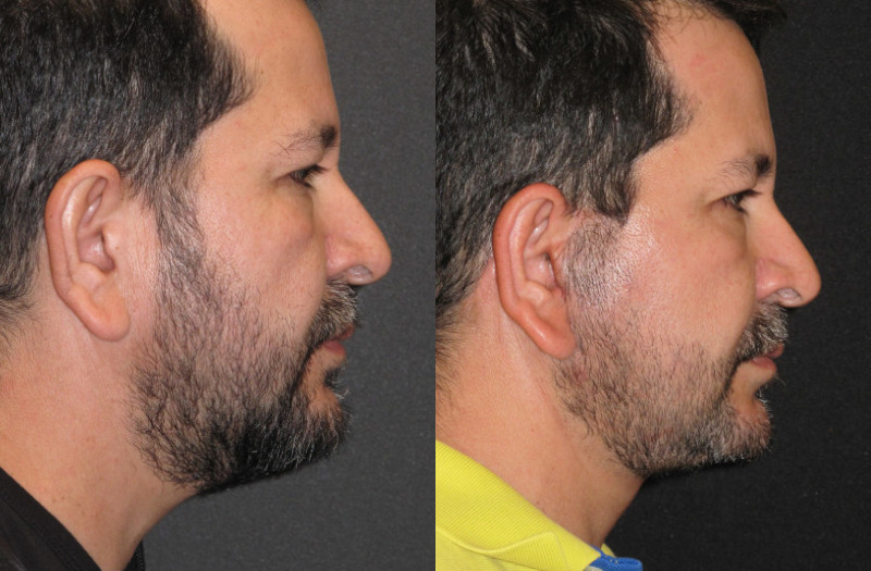 Patient 69 Combined Image