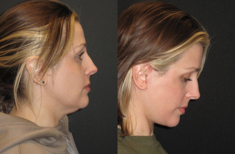 Patient 70 Combined Image