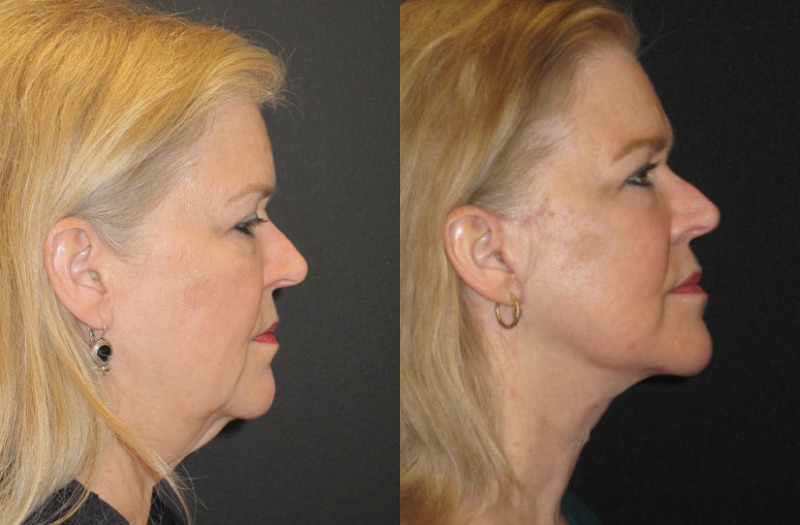 Patient 73 Combined Image