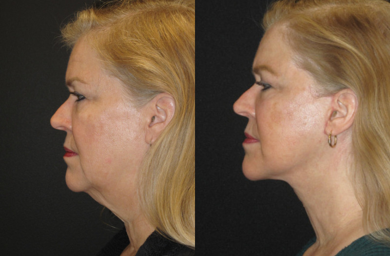 Patient 73 Combined Image