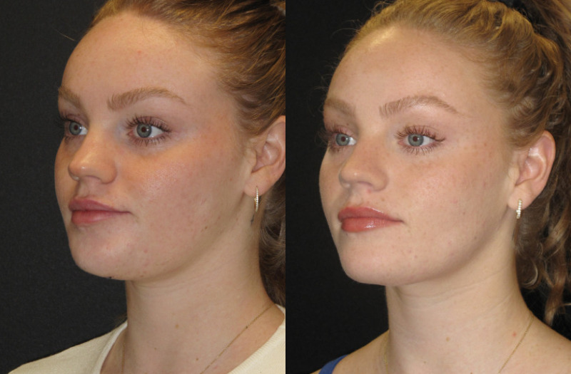 Patient 72 Combined Image