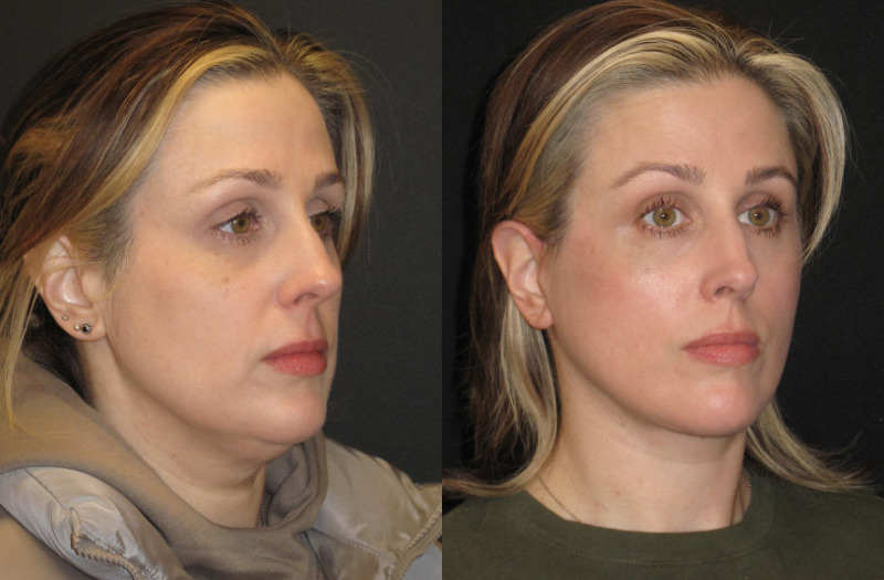 Patient 70 Combined Image