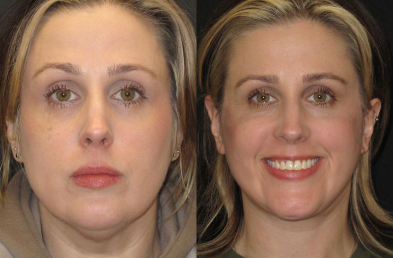 Patient 70 Combined Image