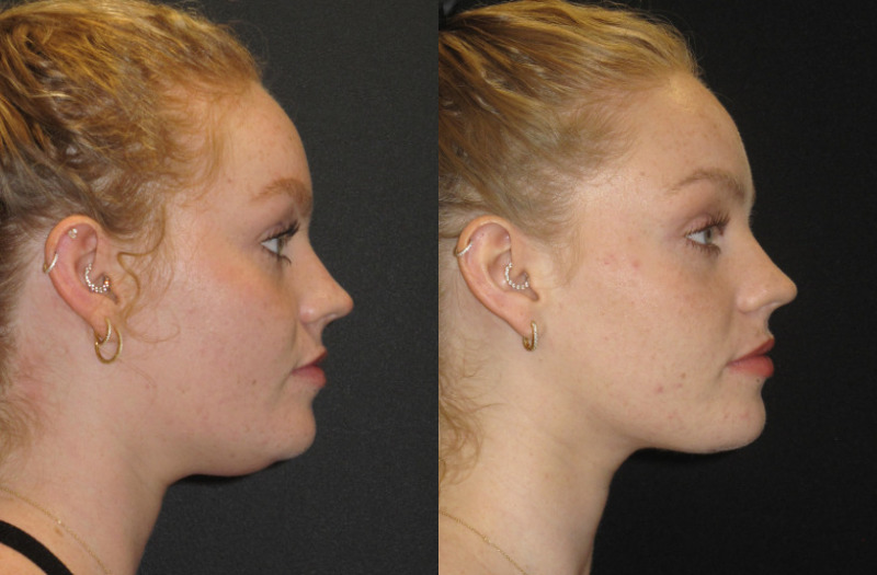 Patient 72 Combined Image