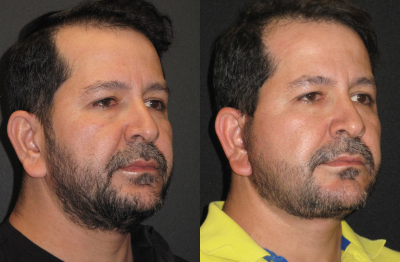 Patient 69 Combined Image