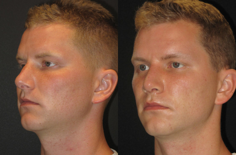 Patient 68 Combined Image